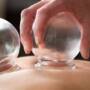 Ventouse humide - Cupping Therapy Liège