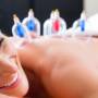Cupping therapy - Clinique esthétique Solvay Liège